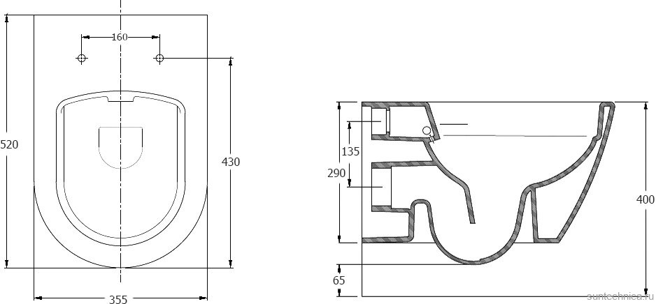 Унитаз подвесной Serel Saphire SP26BMSL с функцией биде, с микролифтом