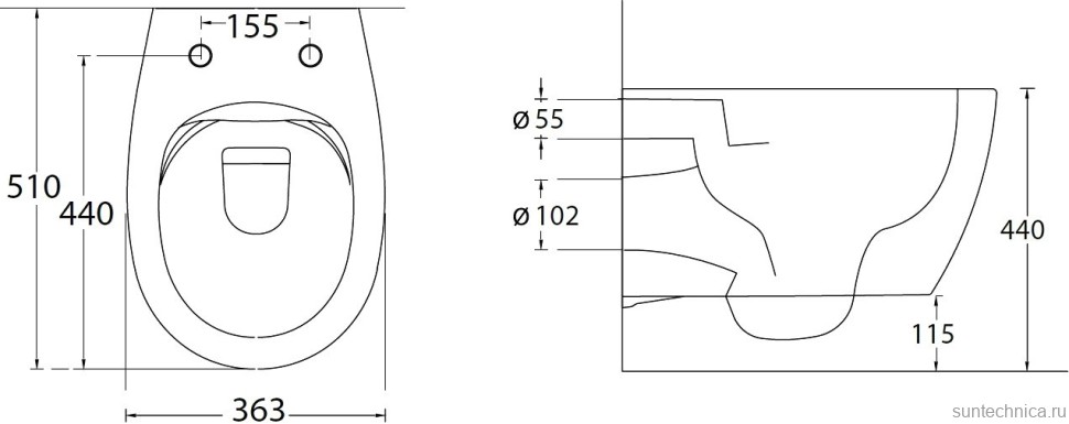 Унитаз подвесной Allen Brau Fantasy 4.11004.PT безободковый, с микролифтом, петроль